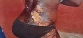 Trader pours hot water on daughter for taking her GH¢5 for food